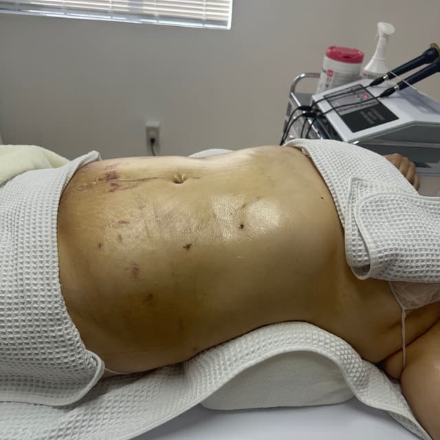 POST OP. (Ultimate) at Luxe Beauty Studio in Cottonwood, AZ
